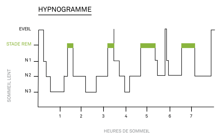 Hypnogramme